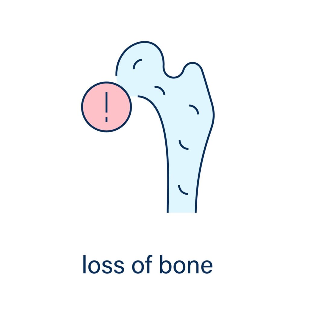 loss of bone